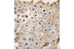 Formalin-fixed and paraffin-embedded human testis tissue reacted with APPBP1 antibody (C-term) , which was peroxidase-conjugated to the secondary antibody, followed by DAB staining. (NAE1 抗体  (C-Term))