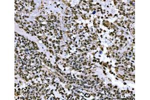 IHC analysis of THAP11 using anti-THAP11 antibody (ABIN7599230). (THAP11 抗体  (AA 1-294))