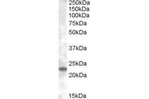Western Blotting (WB) image for anti-RAB17, Member RAS Oncogene Family (RAB17) (AA 102-115) antibody (ABIN490469) (RAB17 抗体  (AA 102-115))
