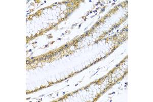 Immunohistochemistry of paraffin-embedded human stomach using GNAI3 antibody at dilution of 1:100 (40x lens). (GNAI3 抗体)