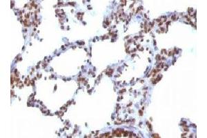 IHC testing of FFPE rat lung with Nuclear Antigen antibody. (Nuclear Antigen 抗体)