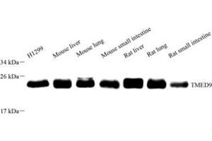 Western blot analysis of TMED9 (ABIN7075988),at dilution of 1: 4000 (TMED9 抗体)