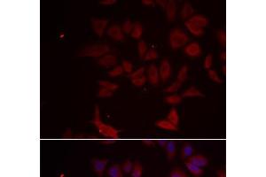 Immunofluorescence analysis of MCF-7 cells using RPL11 Polyclonal Antibody (RPL11 抗体)