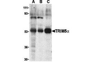 Western Blotting (WB) image for anti-Tripartite Motif Containing 5 (TRIM5) (Middle Region 2) antibody (ABIN1031206) (TRIM5 抗体  (Middle Region 2))