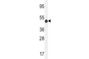 GCNT2 antibody western blot analysis in mouse kidney tissue lysate