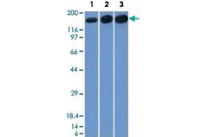 Western Blot analysis of Lane 1: HepG2, Lane 2: HeLa and Lane 3: 3T3 cell lysates with TOP2A monoclonal antibody, clone TOP2A/1361 . (Topoisomerase II alpha 抗体  (AA 1352-1493))