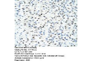 Rabbit Anti-MATR3 Antibody  Paraffin Embedded Tissue: Human Heart Cellular Data: Myocardial cells Antibody Concentration: 4. (MATR3 抗体  (N-Term))