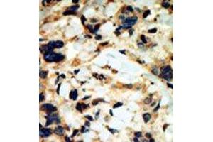 Image no. 1 for anti-serum/glucocorticoid Regulated Kinase 2 (SGK2) (C-Term) antibody (ABIN360349) (SGK2 抗体  (C-Term))