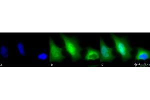 Immunocytochemistry/Immunofluorescence analysis using Rabbit Anti-SOD (Cu/Zn) Polyclonal Antibody . (SOD1 抗体  (FITC))