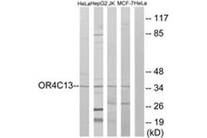 Western blot analysis of extracts from HeLa/Jurkat/HepG2/MCF-7 cells, using OR4C13 Antibody. (OR4C13 抗体  (AA 260-309))
