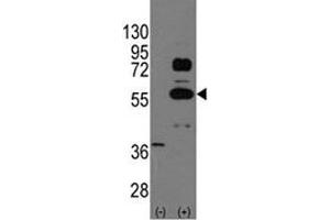 Western blot analysis of SOX9 antibody and 293 cell lysate (2 ug/lane) either nontransfected (Lane 1) or transiently transfected with the SOX9 gene (2). (SOX9 抗体  (AA 41-70))