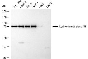 Western blotting analysis using Lysine demethylase 1B antibody (ABIN7799298). (Recombinant KDM1B 抗体)