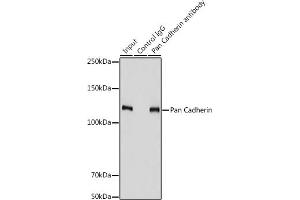 Immunoprecipitation analysis of 900 μg extracts of PC-3 cells using 3 μg Pan Cadherin antibody (ABIN7266233). (CDH1,CDH2,CDH3,CDH4 (AA 800-882) 抗体)