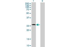 Western Blot analysis of PSPH expression in transfected 293T cell line by PSPH MaxPab polyclonal antibody. (PSPH 抗体  (AA 1-225))