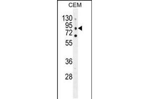 Western blot analysis in CEM cell line lysates (35ug/lane). (CLCN7 抗体  (C-Term))