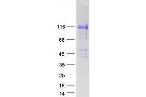 Western Blotting (WB) image for HEAT Repeat Containing 6 (HEATR6) protein (Myc-DYKDDDDK Tag) (ABIN2722551)