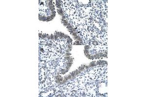 Immunohistochemical staining (Formalin-fixed paraffin-embedded sections) of human lung (A, B) with CCRN4L polyclonal antibody  at 4-8 ug/mL working concentration.