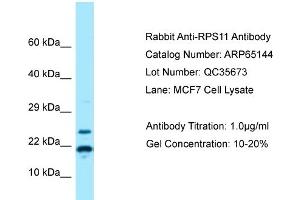 Western Blotting (WB) image for anti-Ribosomal Protein S11 (RPS11) (N-Term) antibody (ABIN2790057) (RPS11 抗体  (N-Term))