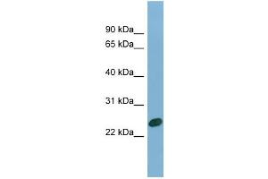 WB Suggested Anti-CHMP1B Antibody Titration: 0. (CHMP1B 抗体  (N-Term))