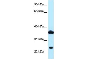 WB Suggested Anti-AKR1C3 Antibody Titration: 1. (AKR1C3 抗体  (N-Term))