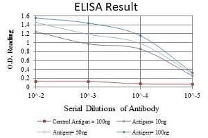 Red: Control Antigen (100 ng), Purple: Antigen (10 ng), Green: Antigen (50 ng), Blue: Antigen (100 ng), (DLGAP1 抗体)