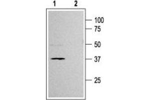 Western Blotting (WB) image for anti-Potassium Inwardly-Rectifying Channel, Subfamily J, Member 11 (KCNJ11) (AA 372-385), (Intracellular) antibody (ABIN7043473)