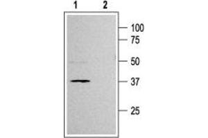 Western blot analysis of rat pancreas membranes: - 1. (KCNJ11 抗体  (C-Term, Intracellular))