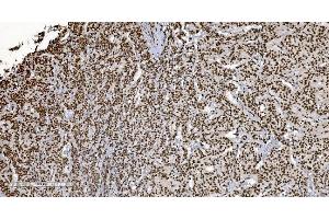 IHC analysis of Ku70 using anti-Ku70 antibody (ABIN7602790).