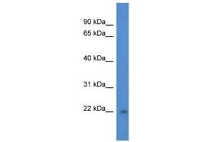 Western Blot showing DGCR6L antibody used at a concentration of 1 ug/ml against Fetal Brain Lysate (DGCR6L 抗体  (C-Term))