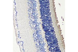 Immunohistochemistry of paraffin-embedded mouse retina using SAG antibody (ABIN6132558, ABIN6147361, ABIN6147362 and ABIN6216887) at dilution of 1:200 (40x lens). (SAG 抗体  (AA 1-405))