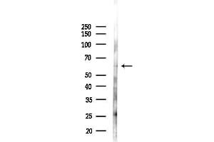 Western blot analysis of lysates from Rat lung, using TSKS Antibody at 1/1000 dilution.