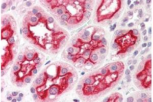 Human Kidney (formalin-fixed, paraffin-embedded) stained with ACE2 antibody ABIN214395 at 2. (ACE2 抗体  (Internal Region))