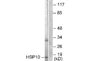 Western blot analysis of extracts from NIH/3T3 cells, using HSP10 antibody (#C0230). (HSPE1 抗体)