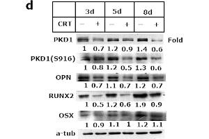 PKD1 contributed to osteoblastic development.