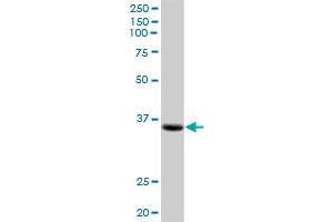 KIAA1166 MaxPab polyclonal antibody. (ZC4H2 抗体  (AA 1-224))