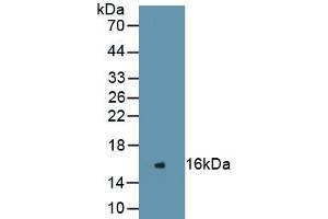 Detection of Recombinant REN, Human using Monoclonal Antibody to Renin (REN) (Renin 抗体  (AA 67-153))