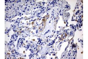 Immunohistochemistry (IHC) image for anti-ATP-Binding Cassette, Sub-Family D (Ald), Member 1 (ABCD1) (AA 508-745) antibody (ABIN2715621) (ABCD1 抗体  (AA 508-745))