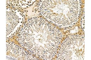 ABIN7095901 and ABIN7099963 at 1/100 staining rat testis tissue by IHC-P. (MED13L 抗体)