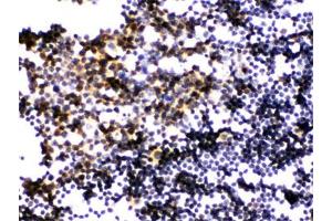 IHC testing of FFPE mouse lymph node with PLK1 antibody.