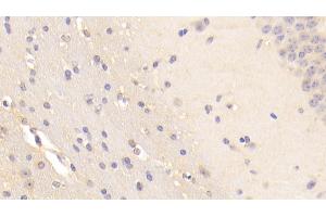 Detection of BFP in Mouse Cerebellum Tissue using Polyclonal Antibody to Brain Finger Protein (BFP) (RNF112 抗体  (AA 403-647))