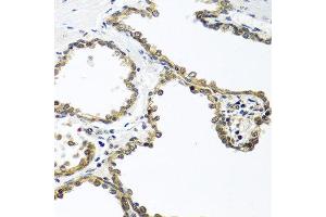 Immunohistochemistry of paraffin-embedded human prostate using ARSF antibody at dilution of 1:100 (40x lens). (ARSF 抗体)