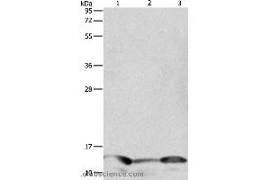 Western blot analysis of Human seminoma tissue, hela and A549 cell, using PFN1 Polyclonal Antibody at dilution of 1:1000 (PFN1 抗体)