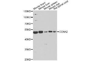 Western blot analysis of extracts of various cell lines, using CCNA2 antibody. (Cyclin A 抗体)