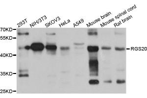 Western blot analysis of extracts of various cell lines, using RGS20 antibody. (RGS20 抗体)