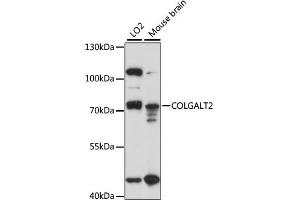 Western blot analysis of extracts of various cell lines, using COLGALT2 antibody (ABIN6294221) at 1:1000 dilution. (GLT25D2 抗体)
