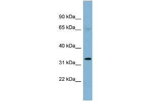 WB Suggested Anti-HEY1 Antibody Titration:  0. (HEY1 抗体  (Middle Region))