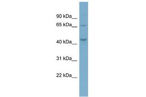 WB Suggested Anti-PIP4K2A Antibody Titration: 0. (PIP4K2A 抗体  (Middle Region))