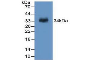 Western blot analysis of recombinant Rat F13A1. (F13A1 抗体  (AA 140-377))