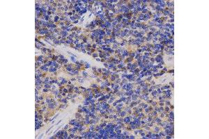 Immunohistochemistry (IHC) image for anti-Adaptor-Related Protein Complex 2, alpha 2 Subunit (AP2A2) antibody (ABIN1876579) (AP2A2 抗体)