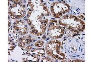 Immunohistochemical staining of paraffin-embedded liver tissue using anti-PASKmouse monoclonal antibody. (PASK 抗体)